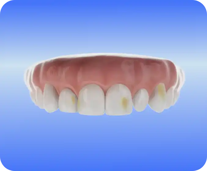 igiene-dentale-macchie-denti-studio-santia-piemonte-torino