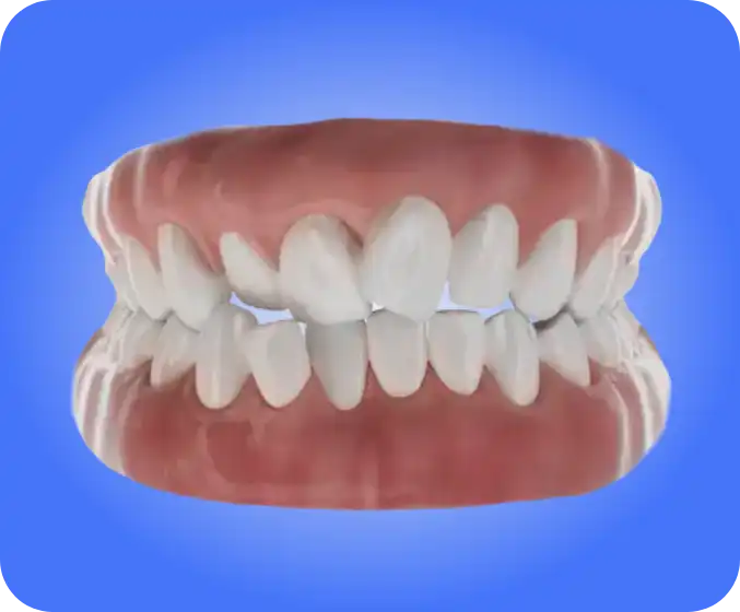 ortodonzia-storti-denti-studio-santia-piemonte-torino