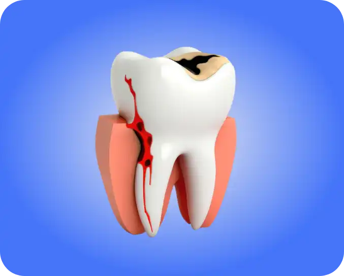 sangue-gengive-denti-studio-santia-piemonte-torino