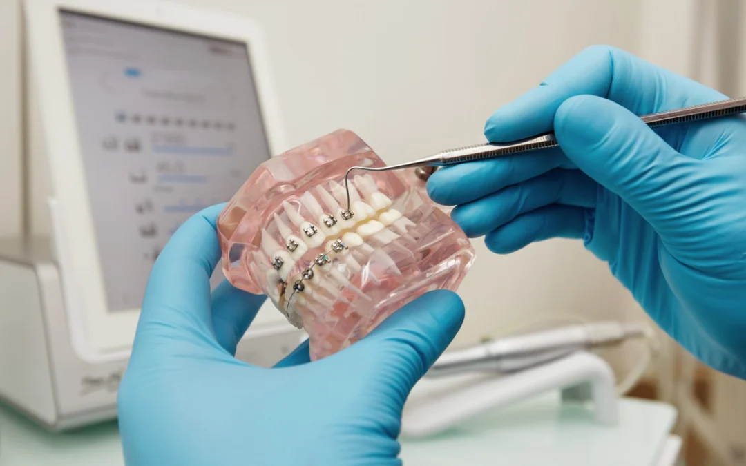 Impianto dentale che si muove o dondola: cosa fare?